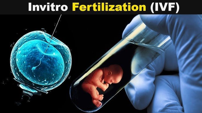 ivf treatment