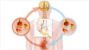 explanation how neuropathic pain occur.