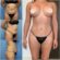 Tummy Tuck in dubai