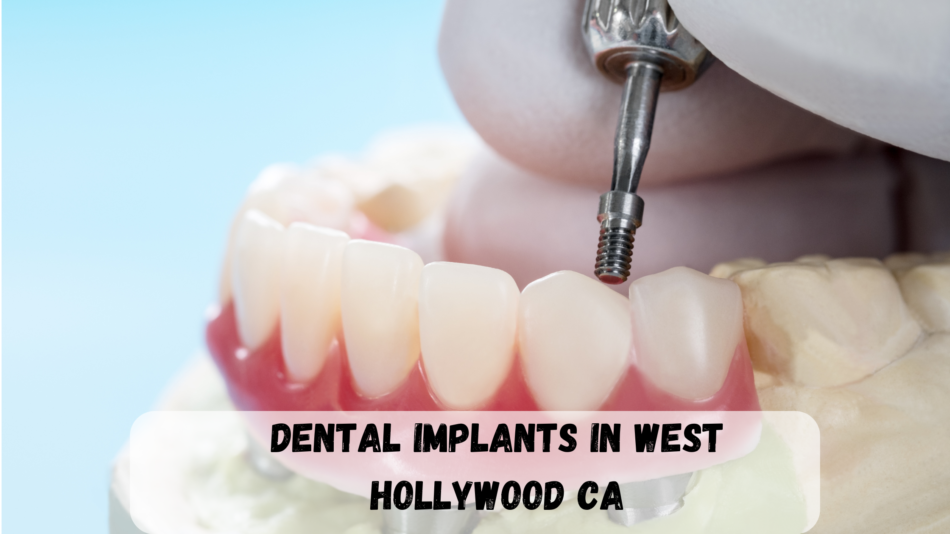dental implants in West Hollywood CA