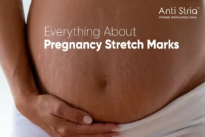 best anti stretch mark cream for pregnancy