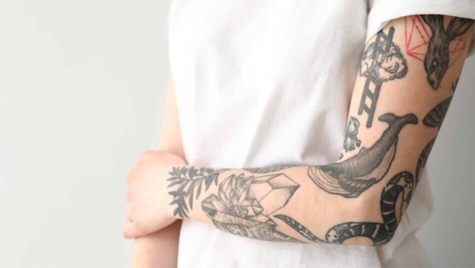Can You Get Laser Hair Removal on a Tattooed Arm or Leg