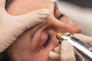 How to Achieve Smoother Skin with Plasma Pen Treatment