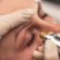 How to Achieve Smoother Skin with Plasma Pen Treatment