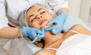 How to Treat Acne Scars Top Solutions for Smooth, Clear Skin