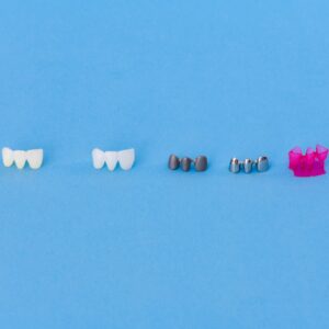 types of dental crowns and cost