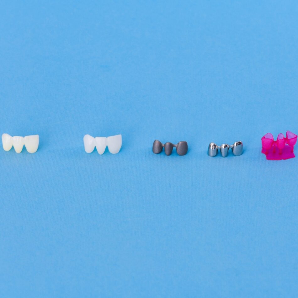 types of dental crowns and cost
