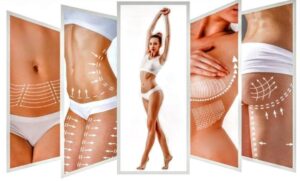 Body Contouring Treatment in Islamabad
