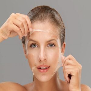 Chemical Peels in Islamabad
