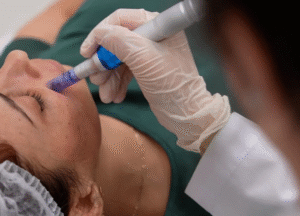 Everything You Need to Know About Exosome Therapy