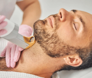 How Beard Laser Hair Removal Works