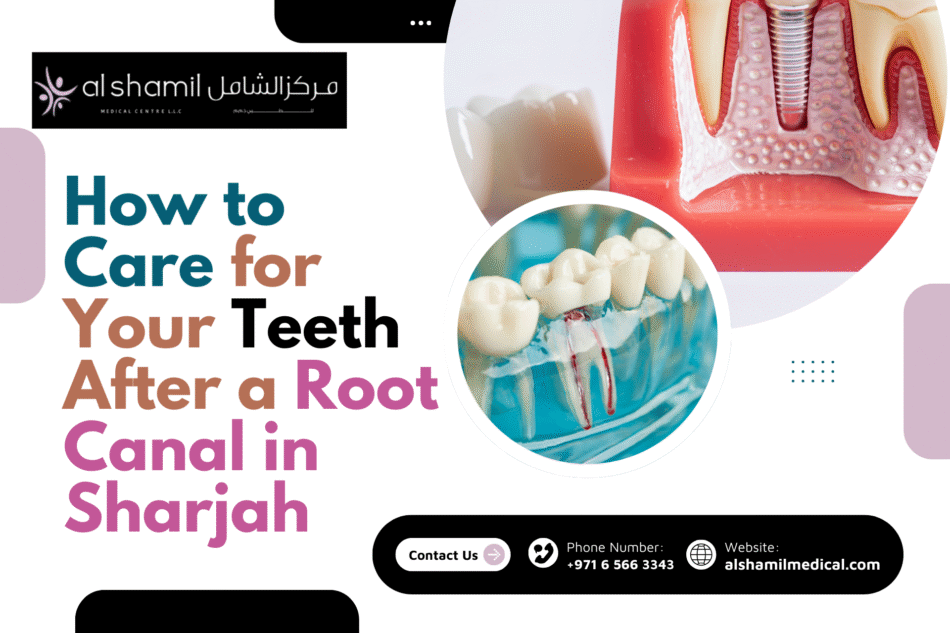How to Care for Your Teeth After a Root Canal in Sharjah