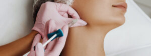 Say Goodbye to Weak Jawlines with Fillers