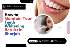 How to Maintain Your Teeth Whitening Results in Sharjah