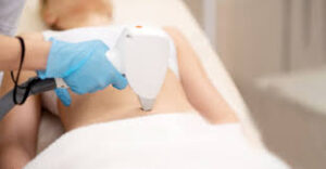 Who Is a Good Candidate for Laser Lipo Treatment
