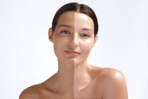 Why Residents Choose Professional Whitening Treatments