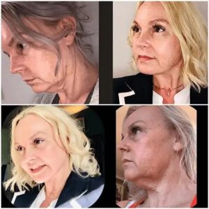 Best Plastic Surgeon in dubai