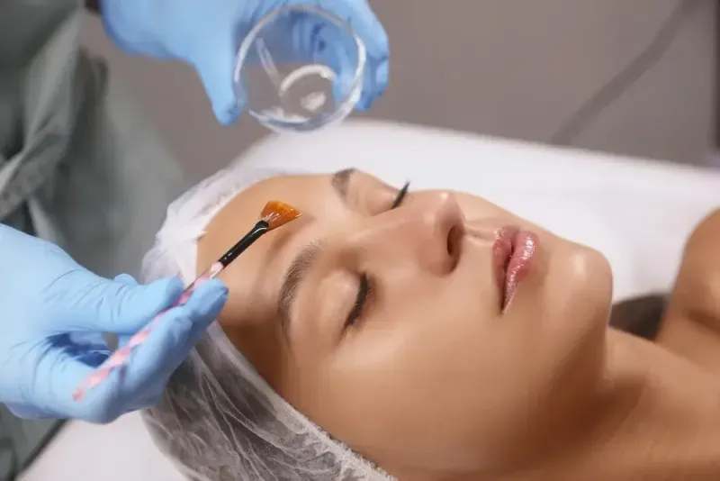 Are Chemical Peels Good for Anti-Aging?