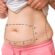 Fast and Effective Mini Tummy Tuck Procedures