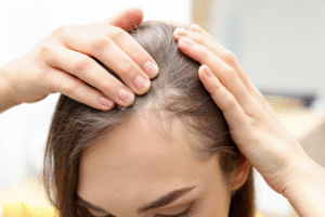 How Long Does PRP Take to Show Hair Growth Results