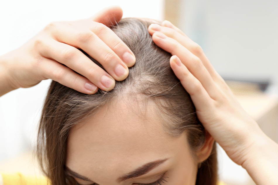 How Long Does PRP Take to Show Hair Growth Results