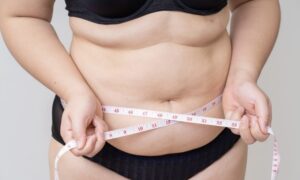 How Fat Transfer in Dubai Can Help Restore Volume to Your Face