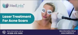 acne scar treatment in Delhi