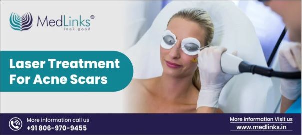 acne scar treatment in Delhi