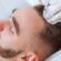 Reclaim Your Hair Confidence with PRP