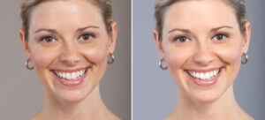 dermatologist in Gurgaon