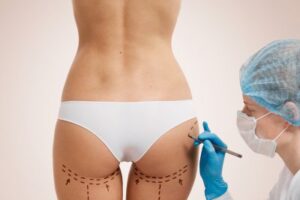 butt fat transfer in dubai