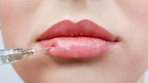 Natürliche Lippenvergrößerung