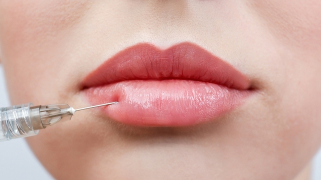 Natürliche Lippenvergrößerung