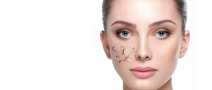 Dry Skin Treatment in Islamabad