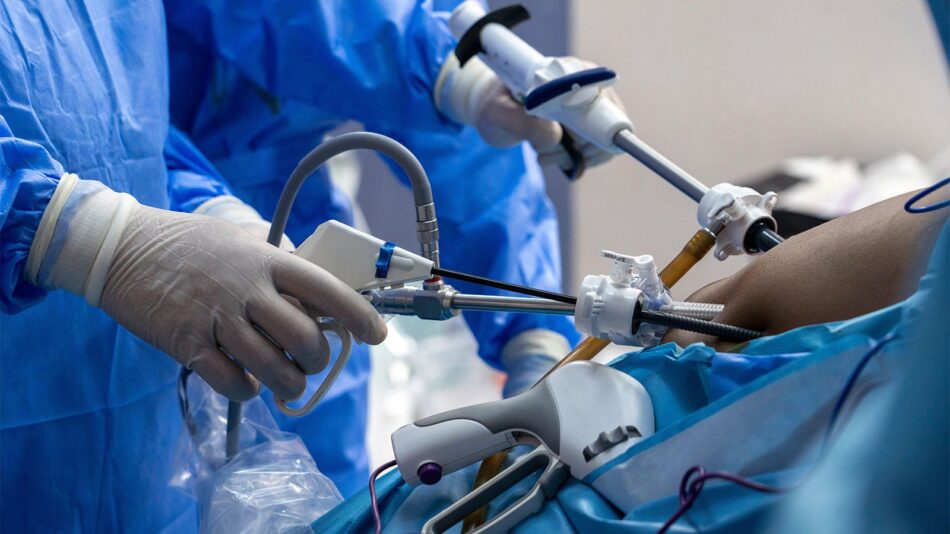 Exploring the Types of Bariatric Surgery Offered