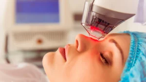 Fractional CO2 Skin Resurfacing
