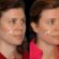 sculptra fillers in dubai