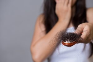 Hair Loss Treatment in Islamabad
