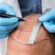 High Quality Hair Transplants at Reasonable Costs