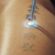 How Does Laser Tattoo Removal Work