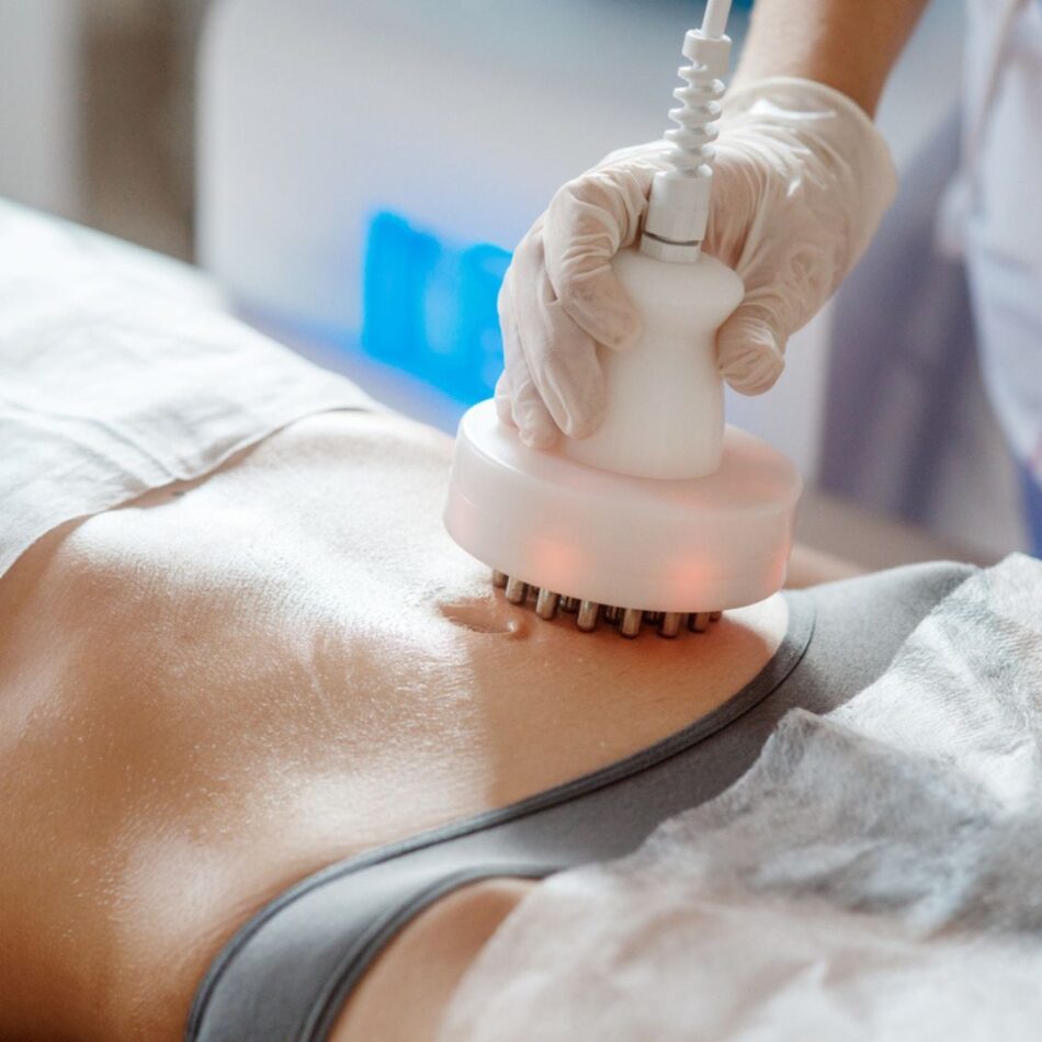 How Does Radiofrequency Treatment Tighten Skin