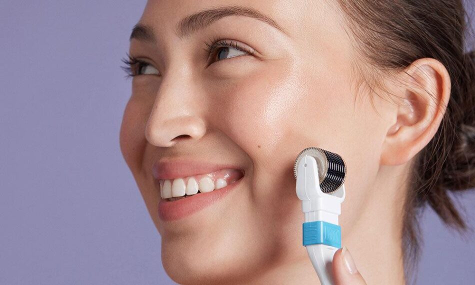 Is Derma Rollers Treatment Good for Dark Spots