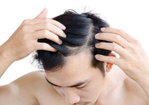 Is Hair Replacement Right for Your Lifestyle?