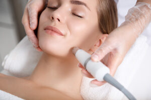 Can I Do Laser for Back or Chest Acne?