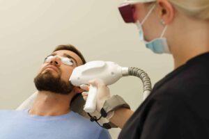 What Is the Process of Beard Laser Hair Removal?