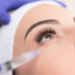 Can Sculptra Be Used Under Eyes?
