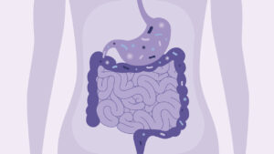 Best Gastroenterologist in Jaipur