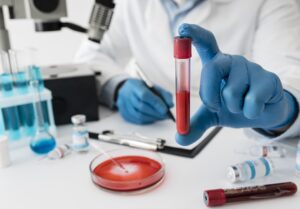Blood Test at Home in Bangalore
