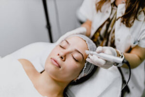 Dermapen Treatment