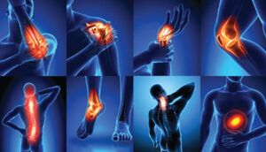 Joint pain—particularly severe or “unbearable” pain from osteoarthritis, rheumatoid arthritis, or degenerative conditions—can greatly impact daily life and mobility.
